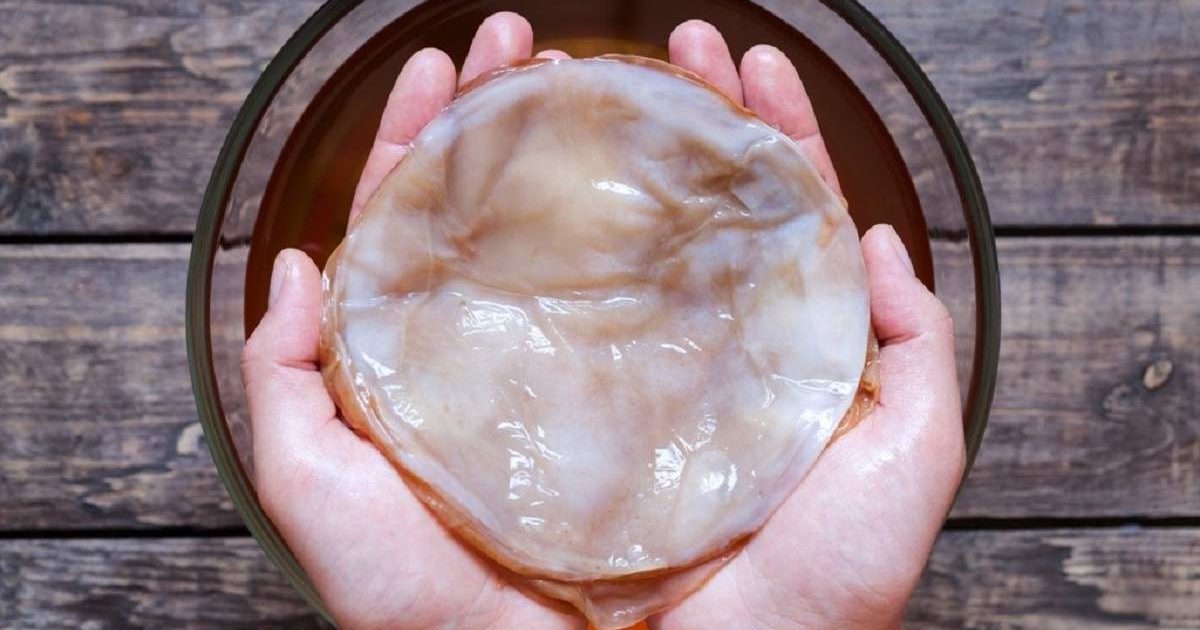 Отглеждане на Комбуча