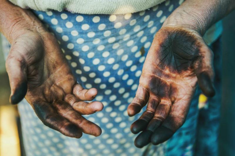 Петна по ръцете на мазна